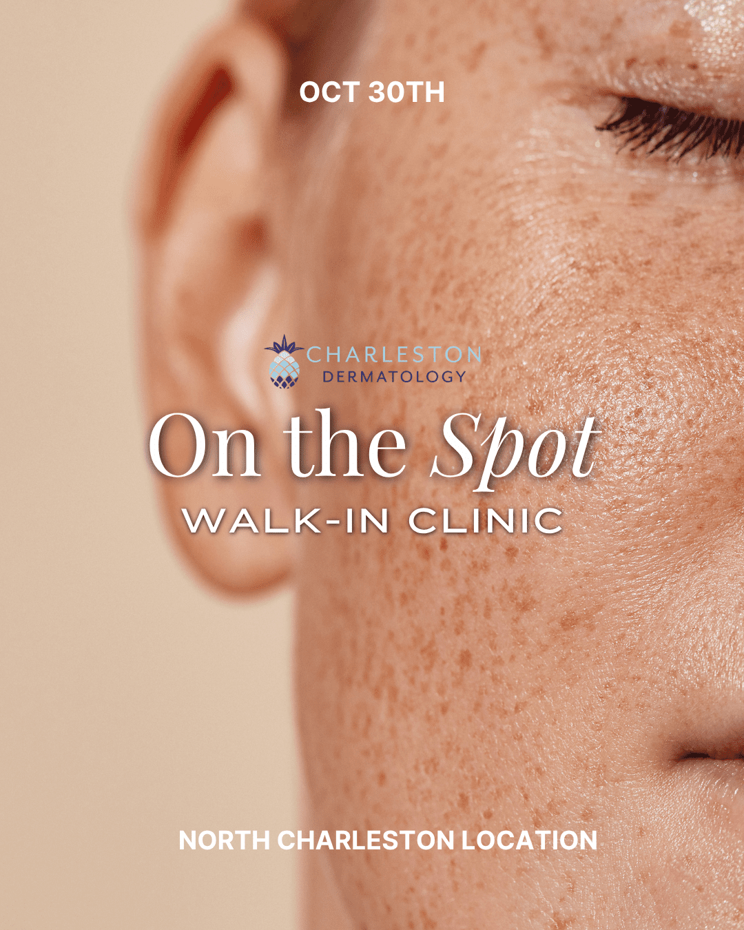 Charleston Dermatology social post promoting the On the Spot walk-in clinic at the North Charleston location